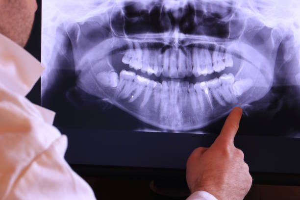 Best Emergency Care for Gum Disease in Whittingham, NJ