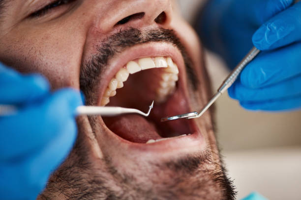 Best Broken or Chipped Tooth Repair in Whittingham, NJ